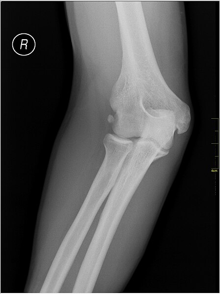 File:Medical X-Ray imaging OUA06 nevit.jpg
