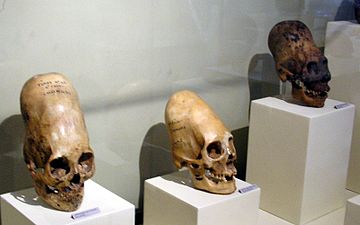 Egendomligt deformerade huvuden från Paracaskulturen utställda i Museo Regional de Ica i Ica.
