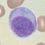 Pienoiskuva sivulle B-solu