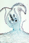 Archegoniophore, longitudinal section