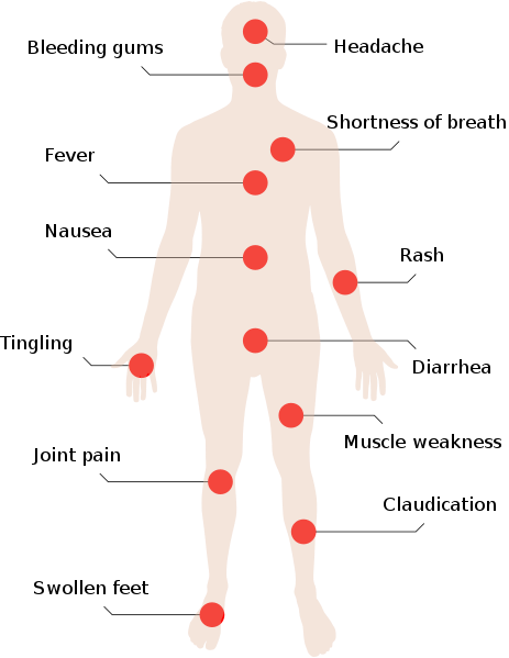 File:Symptoms man.svg