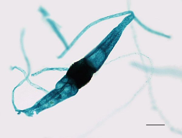 An immature zygosporangium of the Rhizopus fungus forming from two fused gametangia, showing a "yoke" shape.