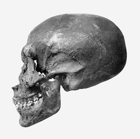 Akhenaten skull profile.png