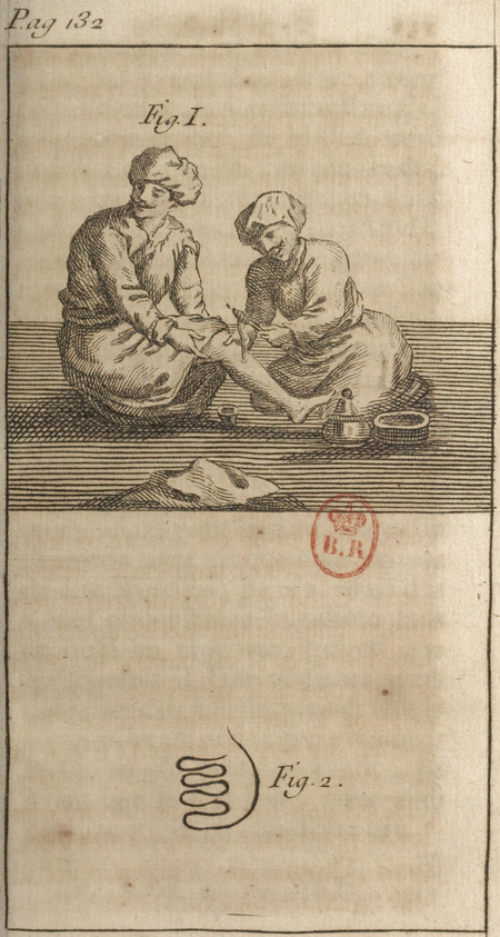Andry - De la génération des vers (1741), planche p. 132.png