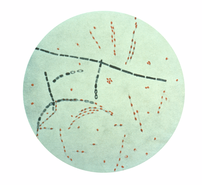 File:Bacillus anthracis.png