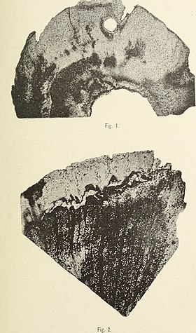 Seções transversais de ossos fossilizados de um Aachenosaurus