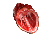 Καρδιακή Ανεπάρκεια