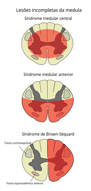 File:Cord pt.svg