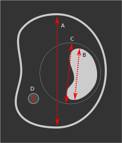 Sep 2015. Main outcome measures Mean gestational sac diameter, crown-rump..