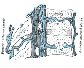 varicoza venelor epidurale ale coloanei vertebrale toracice