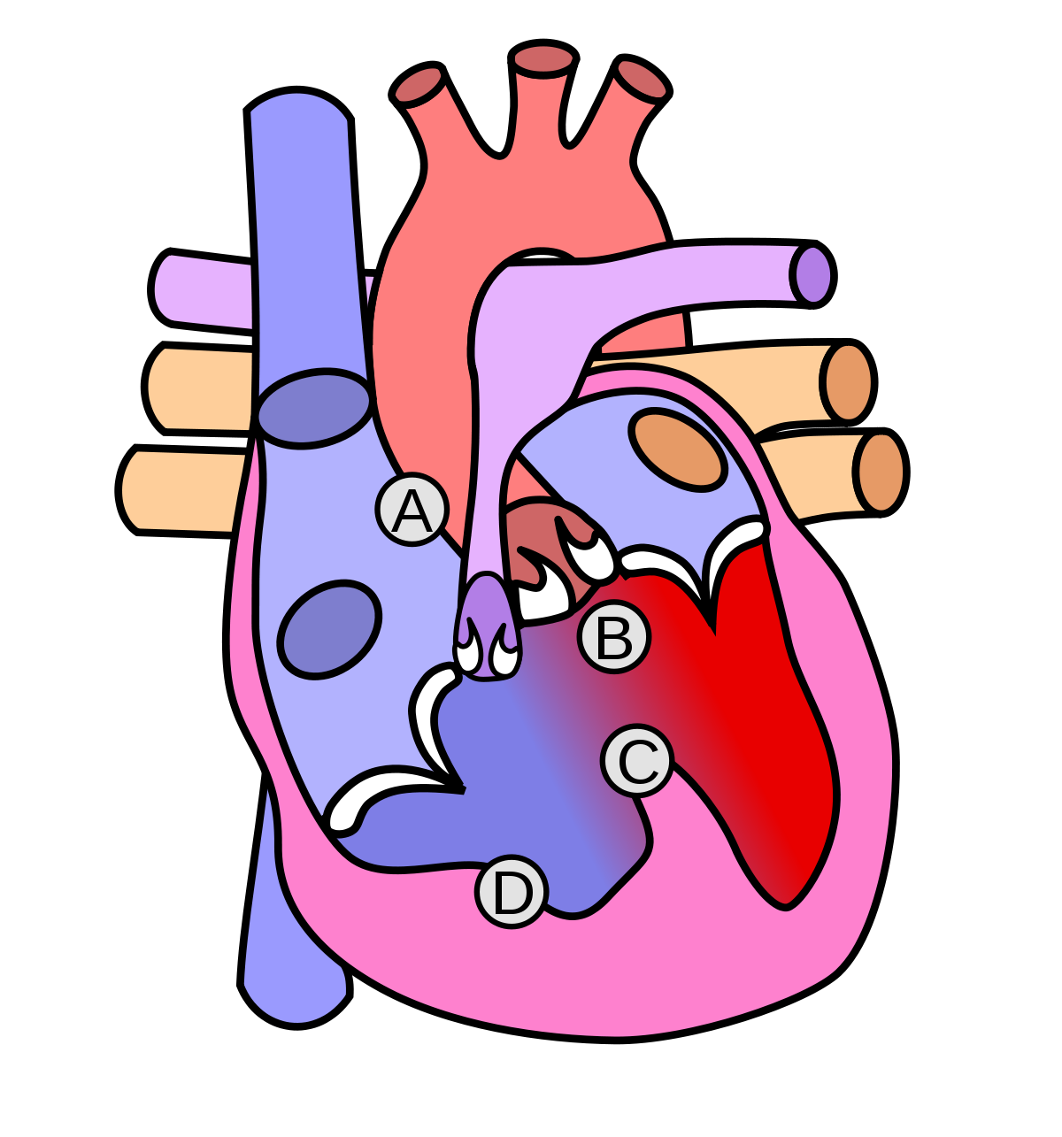 File:Heart tetralogy fallot.svg — Wikimedia Commons