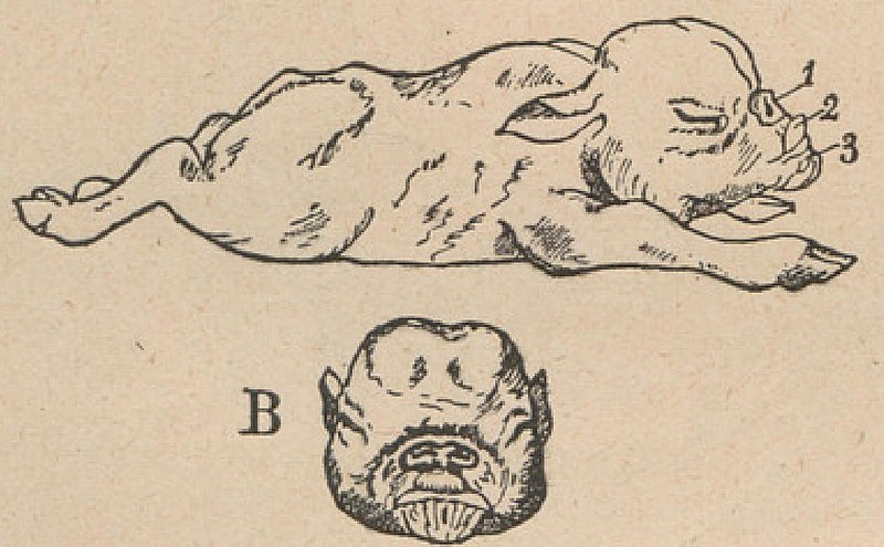 File:Lesbre — Traité de tératologie de l’homme et des animaux domestiques, 1927 (fig. 5).jpg