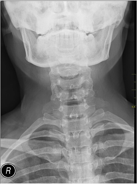 File:Medical X-Ray imaging OWY06 nevit.jpg