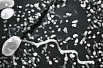Miniatura para Microsporidia