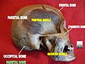 Parietal bone.jpg