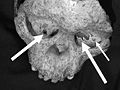 The Taung Child skull with arrows pointing to possible Eagle-caused damage