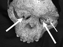 Taung child skull noting raptor-inflicted damage to the eye sockets Taung1.jpg