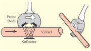 Thumbnail for Ultrasonic flow meter