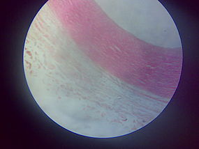 Šematizovan (levo) i mikroskopski prikaz presaka kroz strukture zida aorte