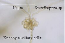 A cluster of knobby auxiliary cells from a species of Scutellospora Auxiliary cells knobby.jpg