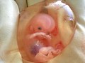 Human fetus 10 weeks with amniotic sac - therapeutic abortion.jpg