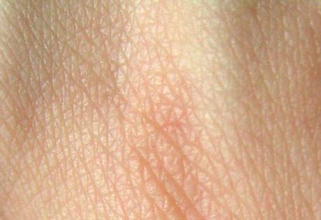 Human skin