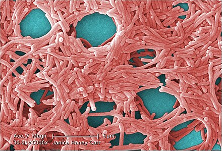 Legionella pneumophila (5000 × magnification)