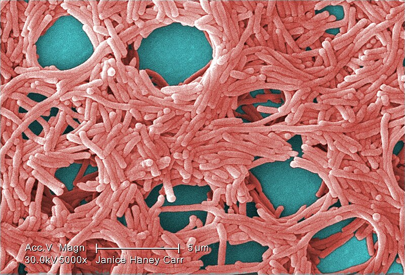 File:Legionella pneumophila (SEM) 2.jpg