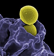 MRSA, opname door Neutrophil.jpg