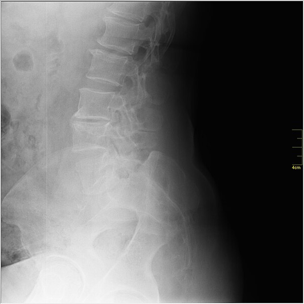 File:Medical X-Ray imaging WIE07 nevit.jpg