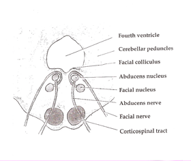 Axial section of the Brainstem (Pons) at the level of the Facial Colliculus Pons section at facial colliculus.png