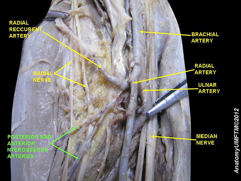 File:Slide3MMMMM.JPG