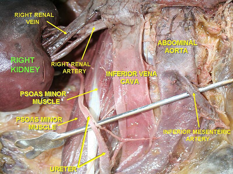 File:Slide5pp.JPG