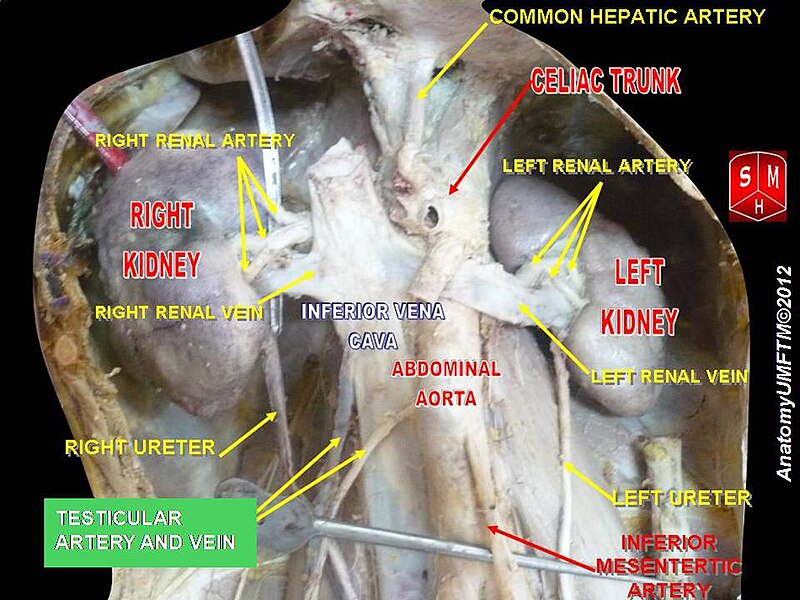 File:Slide6jj.JPG