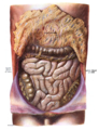 Small intestine in situ, greater omentum folded upwards.
