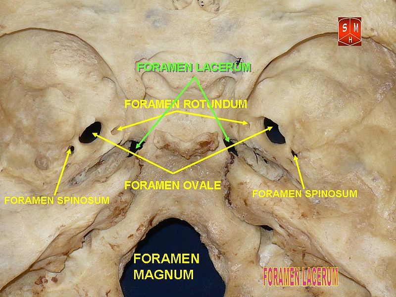 File:Mandibular Nerve.jpg - Wikimedia Commons