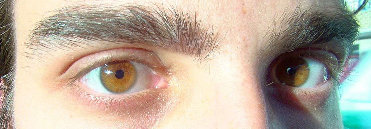 File:Amber-colored-eye.jpg - Wikimedia Commons