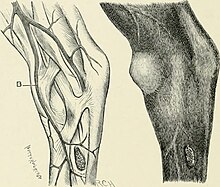 Bog spavin, identified by B on the drawing with the skin removed. Horse bog spavin (1906) (14769128971).jpg