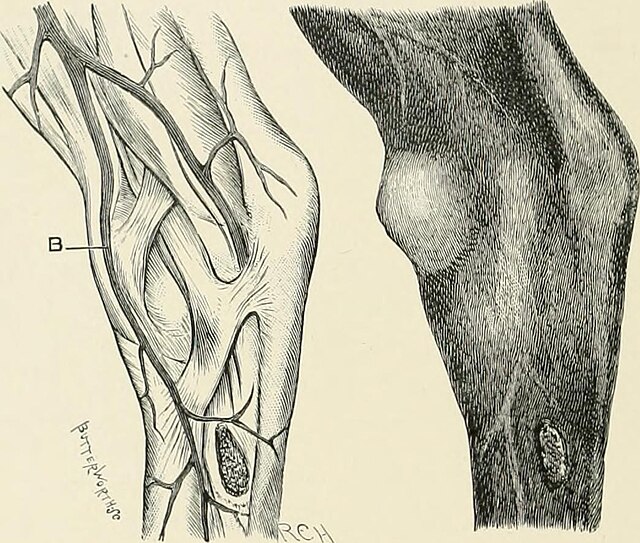 Bone Spavin in Horses: Symptoms, Treatment & Management