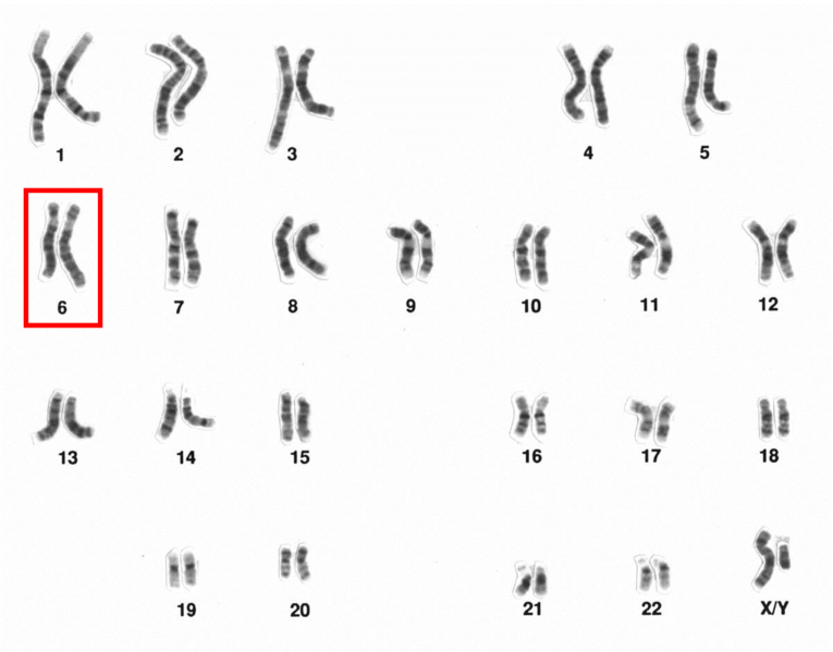 File:Human male karyotpe high resolution - Chromosome 6.png