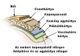 Agyhártyagyulladás: Tünetek, Okai, Diagnózis