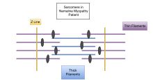 Example of a sarcomere with nemaline rods. Nemaline myopathy sarcomere.svg