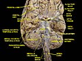 Мозак: доњи аспект, дубока дисекција