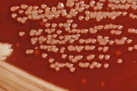 Yersinia enterocolitica colonies growing on XLD agar plates Yersinia enterocolitica 01.png