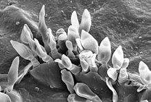 The reproductive conidia of Venturia inaequalis erupting through the cuticle of a crabapple leaf