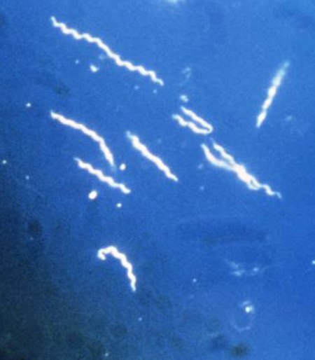 Borrelia burgdorferi-cropped.jpg