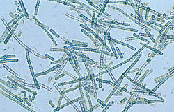 CSIRO ScienceImage 4203 A bluegreen algae species Cylindrospermum sp under magnification.jpg