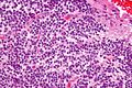 Central neurocytoma - very high mag.jpg