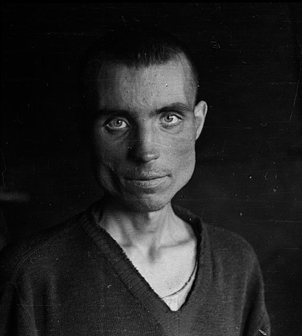 Freed Russian prisoner of war from the Bjørnelva camp in Saltdal, 1945