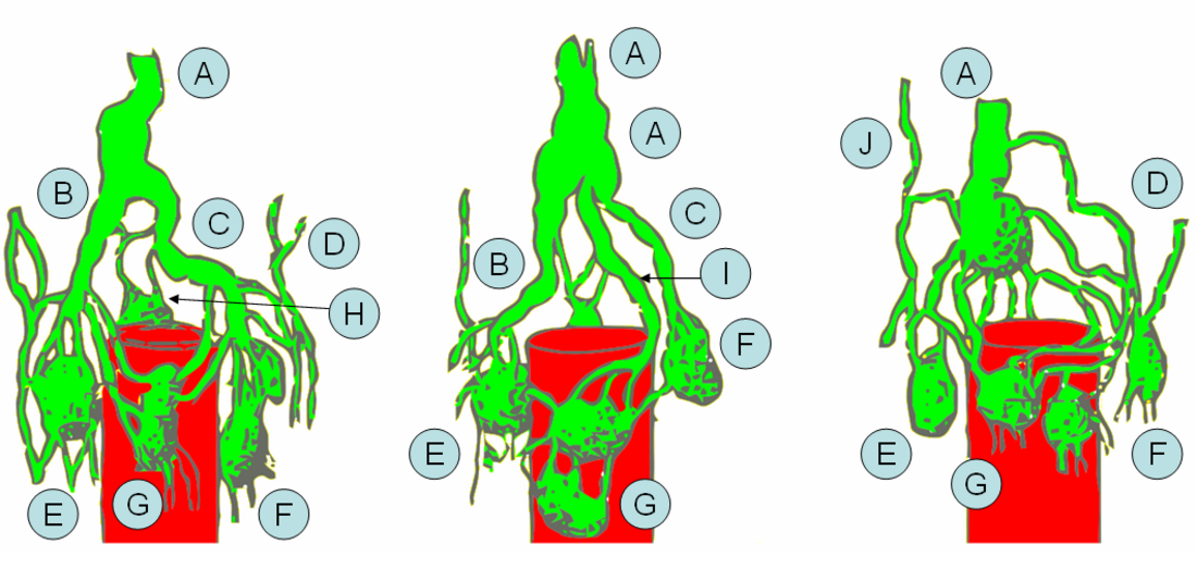 Intestinal lymph trunk